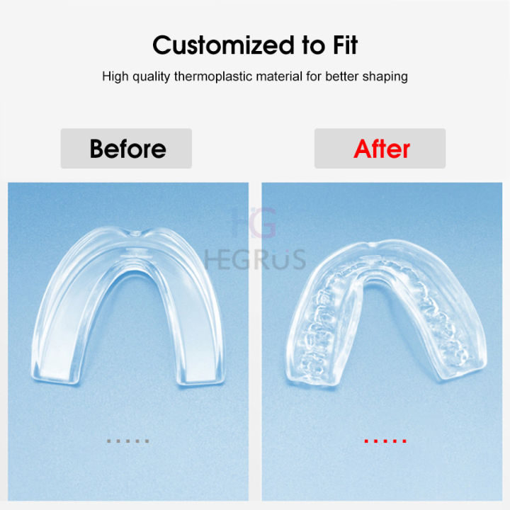 %E3%80%90The-Best%E3%80%91%20New%20HEGRU%204PC%20Orthodontic%20Brace%20Teeth%20Guard%20Night%20Mouth%20Guard%20Dental%20Night%20Guard%20Dental%20Cover%20Teeth%20Retainer%20Tray%20for%20Teeth%20Grinding%20Clenching%20Bruxim%20noring%20Kid%20Adult%20-%20Image%206