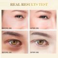 Skincare Products 24K Gold Hyaluronic Acid Eye Mask Remove Dark Eye Circles Collagen Eye Patches Korean Face Care Product. 