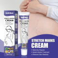 Maternity Cream Improves Elasticity Skin Care Gentle After Pregnancy Stretch Marks Removal Stretch Marks Highly Effective. 