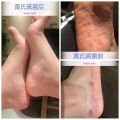 Qin Yitang Huang's Fungal King Antibacterial Official Website Foot Qi Cream Anti Itching Grey Gap Liquid Toothpaste.