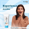 Acne Star Face Wash -50gm (India). 
