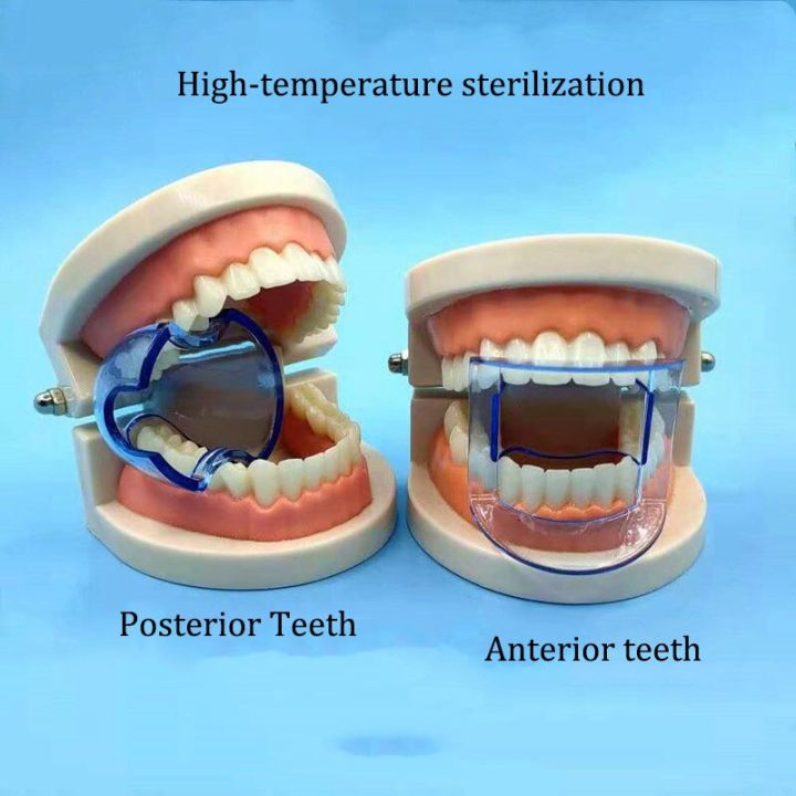 %E3%80%907Rings%20Store%E3%80%915pcs/Set%20Dental%20Mouth%20Opener%20Autoclavable%20Lip%20Retractor%20Cheek%20Expander%20Anterior/Posterior%20Dentistry%20Tool%20Oral%20Dentist%20Materials%20-%20Image%204