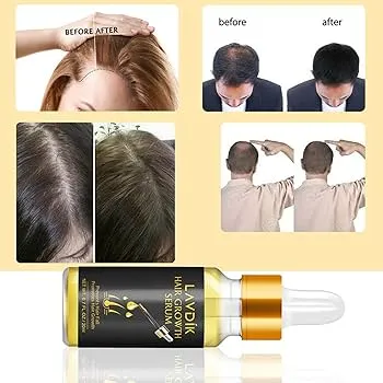 EELHOE%20Hair%20Growth%20Oil-20ml%20-%20Image%203