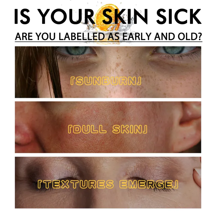 EELHOE%20Vitamin%20C%20Whitening%20Serum%20Face%20Freckle%20Remover%20Fade%20Dark%20Spot%20Pigment%20Melanin%20Corrector%20Brightening%20Skin%20Whitening%20Serum%20-%20Image%206