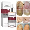 LANBENA Nail Repair Essence Serum Fungal Nail Treatment Remove Onychomycosis Toe Nourishing Brighten Hand Foot Skin Care 12ml.