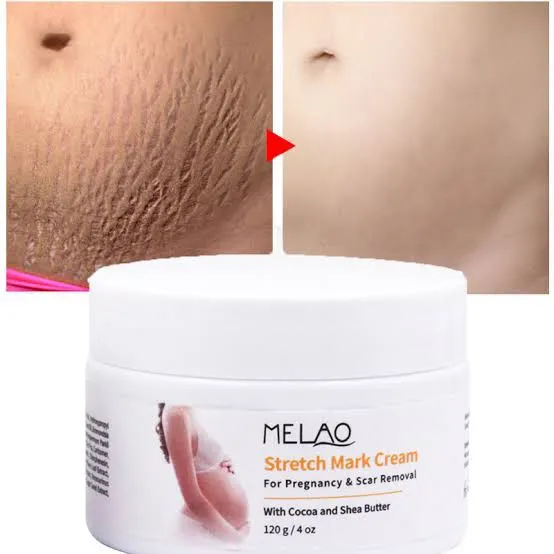MELAO%20Women%20Remove%20Pregnancy%20Scars%20Acne%20Cream%20Stretch%20Marks%20Treatment%20Maternity%20Repair%20Anti-Aging%20%20Body%20Creams-120gm%20-%20Image%203
