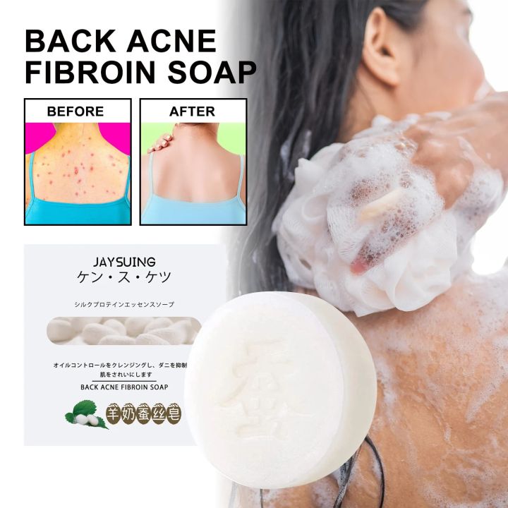 Anti%20Back%20Acne%20Soap%20Remove%20Pimple%20Oil%20Control%20Reduce%20Mite%20Anti%20Inflammation%20Deep%20Cleansing%20Acne%20Treatment%20Moisture%20Whiten%20Soap%20-%20Image%205
