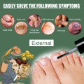 EELHOE Makes Your Nail Clean EELHOE Nail Repair Serum Nail Repair Oil 15ML.