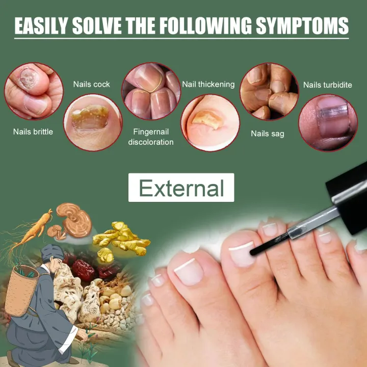 EELHOE%20Makes%20Your%20Nail%20Clean%20EELHOE%20Nail%20Repair%20Serum%20Nail%20Repair%20Oil%2015ML%20-%20Image%203