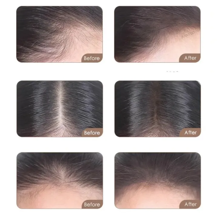 3%20Colors%20Portable%20Hairline%20Stick%20%20Refill%20Shadow%20Powder%20/%20Waterproof%20And%20Sweatproof%20Hair%20Line%20Modified%20Repair%20Stick%20/%20Multi-Purpose%20Trim%20Facial%20Contours%20Eyebrows%20Cosmetics%20-%20Image%205