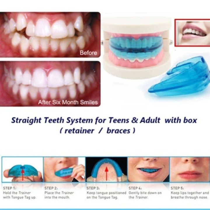 %E3%80%90User-friendly%E3%80%91%20New%20Portable%20Teeth%20Retainer%20Durable%20Dental%20Brace%20EVA%20Teeth%20Alignment%20Trainer%20-%20Image%207