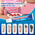 10PCs suifun diabetes foot cream skin ulcer ointment pain relief anti infection crack diabetic accessories Chinese medicine.