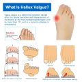 Silicone Gel Thumb Corrector Bunion Foot Toe Hallux Valgus Protector Separator Finger Straightener Adjuster Foot Care Tools. 