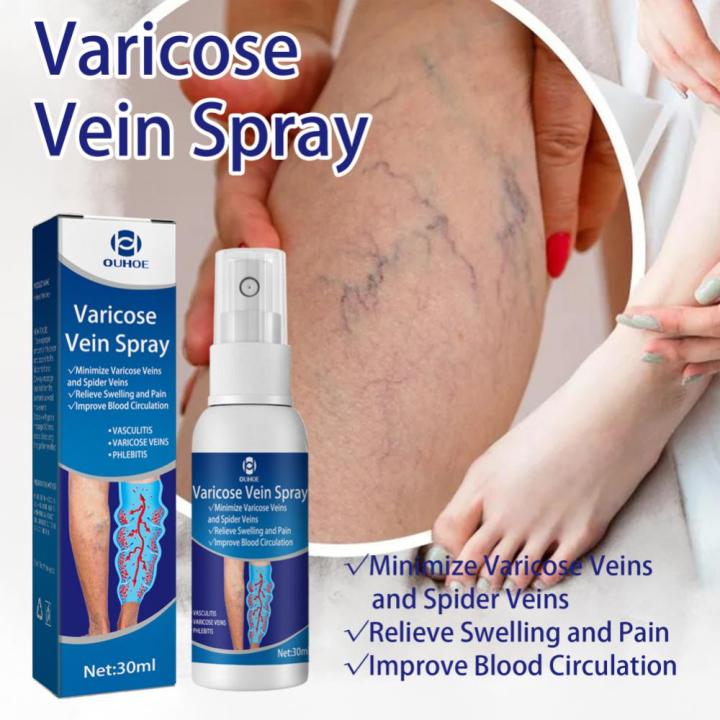 %E3%80%90Top-Rated%20Product%E3%80%91%20Varicose%20Veins%20Spray%20Spider%20Veins%20Relief%20Vasculitis%20Phlebitis%20Spider%20Pain%20Relief%20Plaster%20Care%2030ml%20-%20Image%203