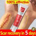 Fast Scar Removal Cream Effective Treatment Stretch Marks Burn Surgical Scars Acne Spots Repair Whitening Moisturizing Skin Care.