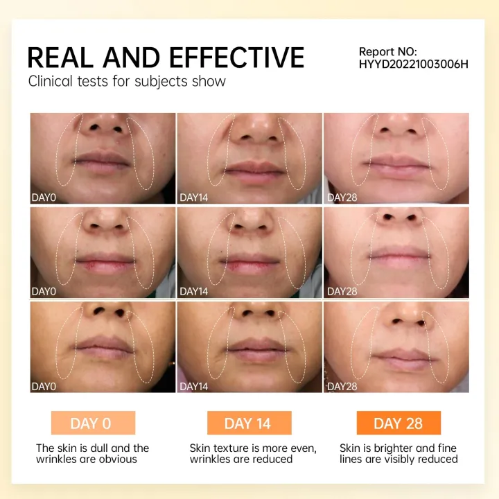 Jellyprim%20Vitamin%20C%20Face%20Cream%20Whitening%20Cream%20for%20Dark%20Skin%20Remove%20Spots%20Acne%20Marks%20Skincare%20Niacinamide%20Brightening%20Anit-Aging%20-%20Image%205