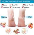 Heel Anti Crack Vented Moisturizing Silicone Heel Socks for Swelling, Pain Relief, Foot Care Ankle Support Pad-2 Pcs.