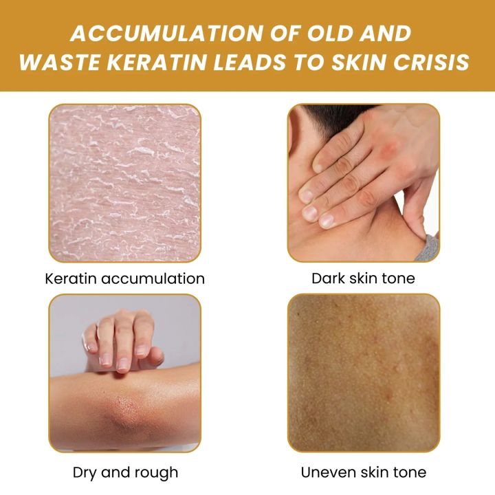 Exfoliating%20Gel%20Peeling%20Fade%20Acne%20Marks%20Dark%20Spot%20Dead%20Skin%20Removal%20Whitening%20Moisturizing%20Smooth%20Exfoliator%20Turmeric%20Body%20Scrub%20-%20Image%204