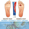 Diabetes Treatment Foot Cream Repair Feet Ulceration Relieve Itchy Improve Heel Cracking Nourishing Blood Sugar Care Ointment. 