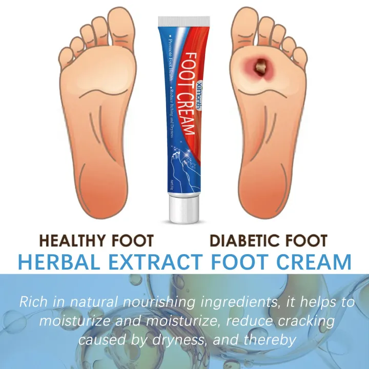 Diabetes%20Treatment%20Foot%20Cream%20Repair%20Feet%20Ulceration%20Relieve%20Itchy%20Improve%20Heel%20Cracking%20Nourishing%20Blood%20Sugar%20Care%20Ointment%20-%20Image%205