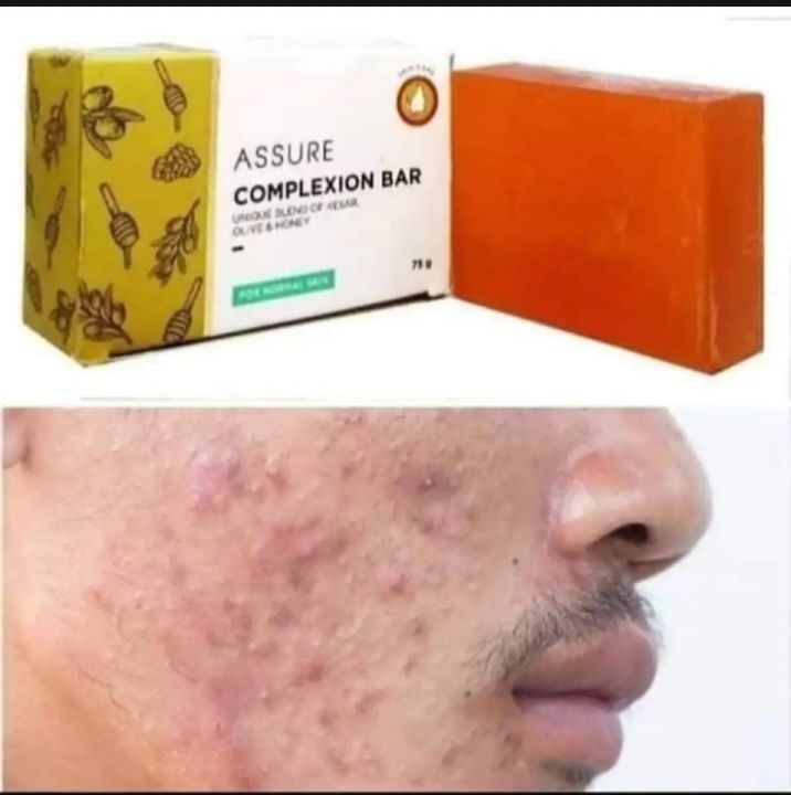 Assure%20Complexion%20bar%20Soap%2075g%20Indian%20Honey%20is%20enriched%20with%20olives%20and%20saffron%20-%20Image%207