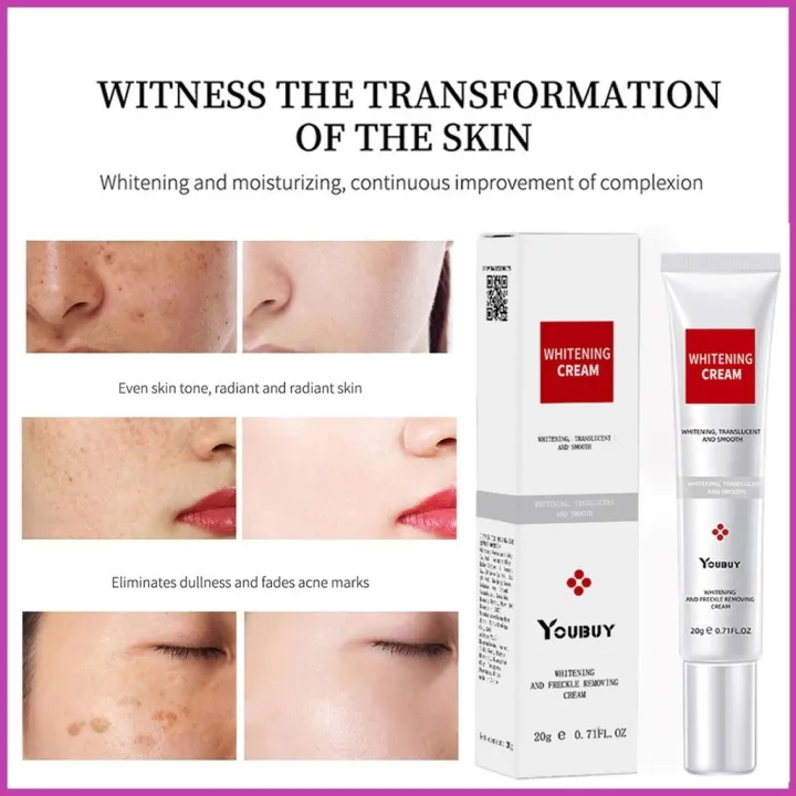 YOUBUY%20Whitening%20Freckle%20Cream%20Remove%20Dark%20Spots%20Anti%20Freckle%20Cream%20Niacinamide%20Fade%20Pigmentation%20Melasma%20Brighten%20-%20Image%203