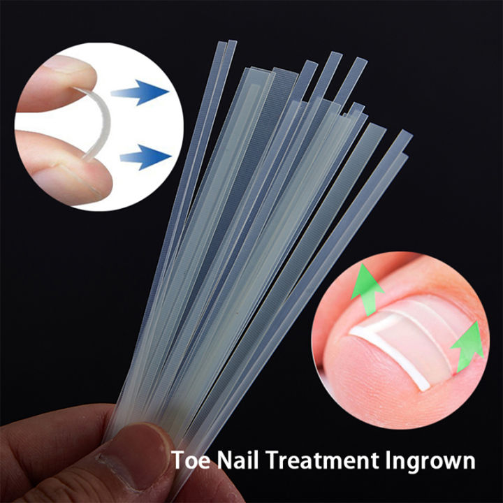5Pcs Ingrown Toe Nail Treatment Ingrown Toenail Correction Tool Elastic Patch Sticker Straightening Clip Brace Pedicure Tools Huiye