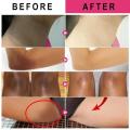 Whitening Cream for Dark Skin Armpit Intimate Areas Brighten Lotion Lightening Underarm Dull Body Skin Care Private Parts Bleach. 