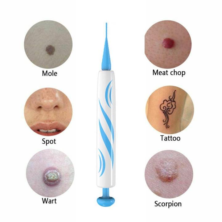 2%20IN%201%20Auto%20Micro%20Skin%20Tag%20Remover%20Pen%20Standard%20Micro%20Skin%20Tag%20Removal%20Kit%20-%20Image%203