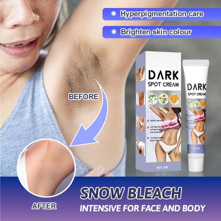 Inner%20Thigh%20Lightening%20Cream%20Black%20Spot%20Remover%20for%20Inner%20Thighs%20and%20Armpits%20Intimate%20Area%20Black%20Armpit%20and%20Spot%20Remover%2020g%20-%20Image%202