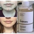 The Ordinary Glycolic Acid 7% Toning Solution - 240ml. 