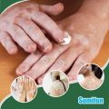 Sumifun Vitiligo Care Cream, Vitiligo Treatment, Reduces White Spots on Skin, Pigmentation regulating 20G. 