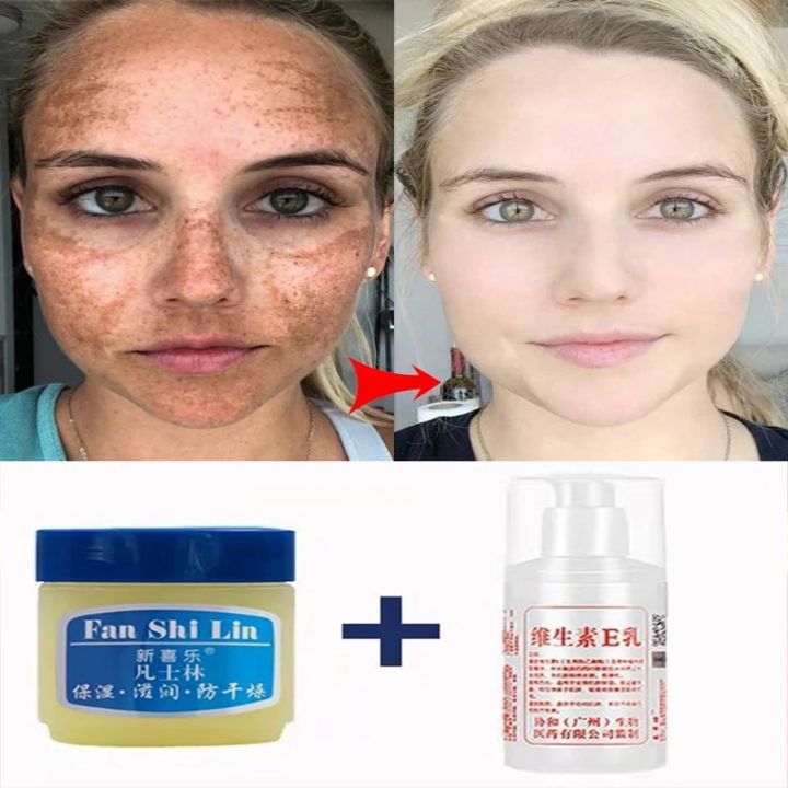 2Pcs Remove Black Skin Face Cream Vaseline Vitamin E Cream Set Whitening Moisturizing Nourishing Repair Cream Women Skin Care