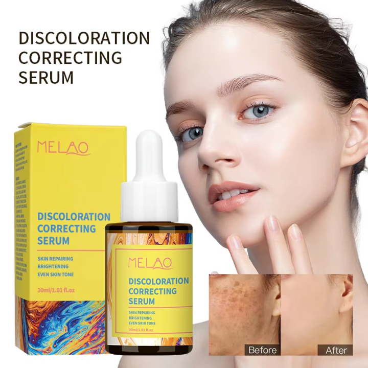 〽️ Melao Discoloration Correcting Serum – 30ml | Skin Repairing ...