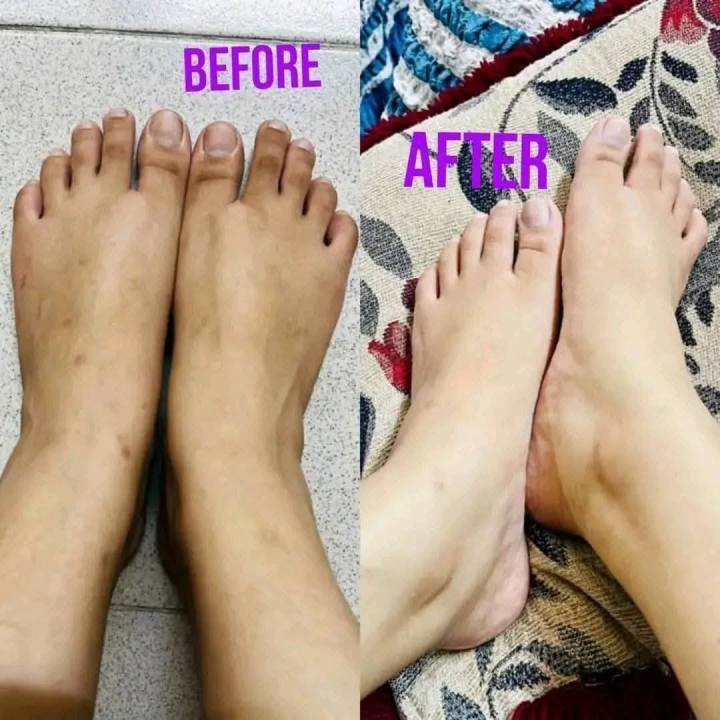 Authentic%20Kem%20Cot%20Thai%20Whitening%20Body%20Cream%20-%20Image%203