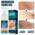 50ml Scar Removal Gel - Effective Stretch Mark, Acnes Spots, Burns and Surgical Scars Treatment Cream - Retinol, Allantoin,Vitamin E - Post Surgery Skin Repair Supplies No Side Effects. 