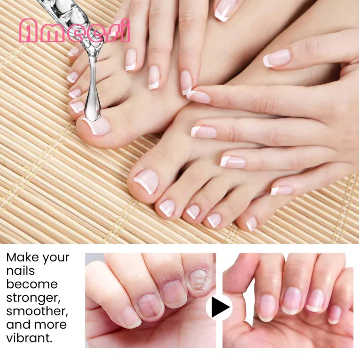 Nail%20Strengthening%20Oil%2015ml%20Nail%20Strengthening%20Cuticle%20Oil%20Repair%20Damaged%20Nails%20Moisturize%20Cuticles%20Natural%20Ingredients%20Fast%20Results%20Damaged%20Nail%20Repair%20Oil%20-%20Image%209