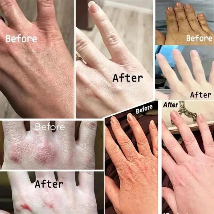 Collagen%20Anti-wrinkle%20Hand%20Cream%20Whitening%20Moisturising%20Dry%20Skin%20Repair%20Products%20Softening%20Nourishing%20Anti-dry%20Korean%20Skin%20Care%20-%20Image%205