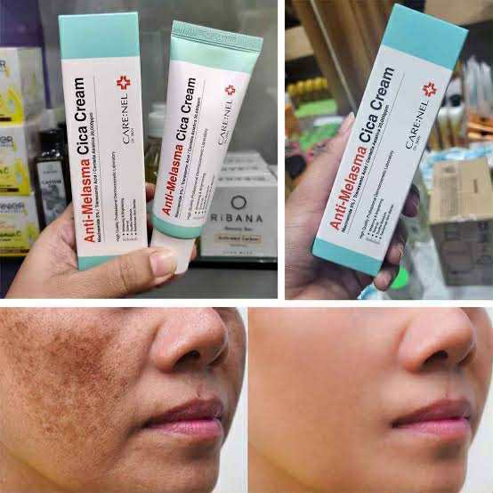 CARENEL%20Anti-Melasma%20Cica%20Cream%2040ml%20-%20Image%204