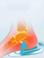 2 Pcs Soft Silicone Gel Heel cup shoe Insoles Pads for Men and Women Pain Relief, Foot Heel Crack Heal Achilles Tendinitis Shock Absorbing Shoe Pad Height Increase Inserts.