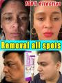 Melasma Remover Cream Removal Dark Pigment Brighten Cream Face Fade Melanin Cream Nicotinamide Brightening Moisturizing Emulsion.