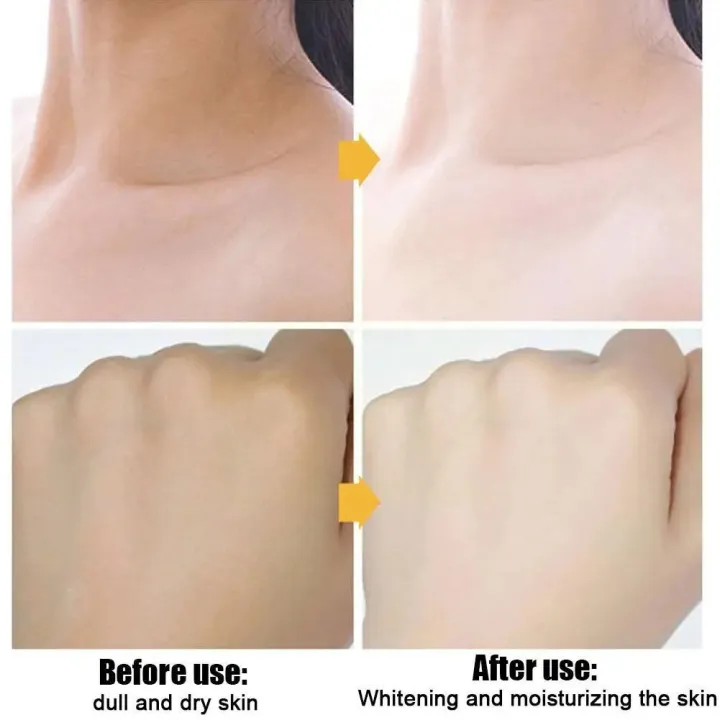 50g%20V7%20Toning%20Light%20Face%20Cream%20Brighten%20Skin%20Tone%20Fade%20Hydrating%20Non%20Creams%20Aging%20Greasy%20Anti%20Whitening%20Moisturizing%20Blemis%20R1A9%20-%20Image%206