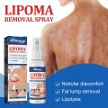 Lipomas Removal Spray Relief Pain Treat Skin Swelling 50ml Nodule Removal Cellulite Spray Lipolysis Ointment Fat Lump U6M8.