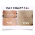 Fushiting Salicylic Acid Mask Hydrating Moisturizing Blackhead Spraying Sleeping Mask Mask Wholesale Wholesale. 