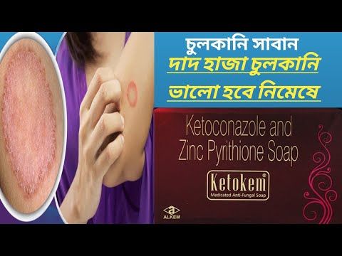 Ketokem%20Medicated%20Anti-Fungal%20Soap%20-%2075gm%20-%20Image%208