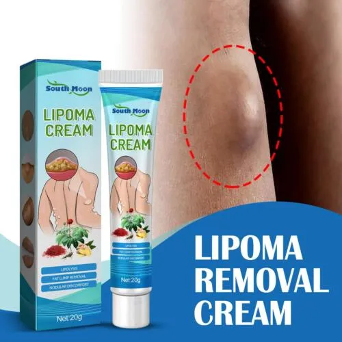 Lipoma%20Removal%20Cream%20Mild%20Care%20Cream%20Wide%20Applications%20For%20Multiple%20Uses%20%7C%20Neck%20Fat%20Pack%7C%20Shoulder%20Fat%7C%20Body%20Lump%7C20%20-%20Image%202
