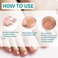 Pexmen 10/20/50/100Pcs Ingrown Toenail Correction Stickers Toenail Corrector Patch Keep Nails Healthy Relieve Pain.