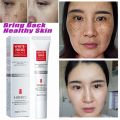 Whitening Freckle Cream Effective Remove Melasma Cream Remove Dark Spots Melanin Moisturize Brighten Smooth Face Skin Care.