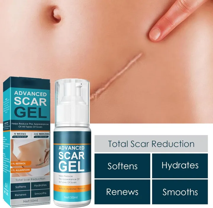 Advanced%20Scar%20Gel%20For%20Acne%20Scars%20Stretch%20Mark%20Removal%20Cream%20Advanced%20Scar%20Treatment%2050ml,Natural%20Scar%20Therapeuti%20Gel,Advanced%20Skin%20Renewal%20Gel,Scar%20Removal%20Cream%20for%20Old%20Scars%20(1%20Pcs)%20-%20Image%203