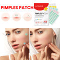 200Pcs Invisible Acne Removal Pimple Patch Beauty Acne Tool Colorful Pimple Acne Mask Concealer Face Spot Scar Care Sticker. 